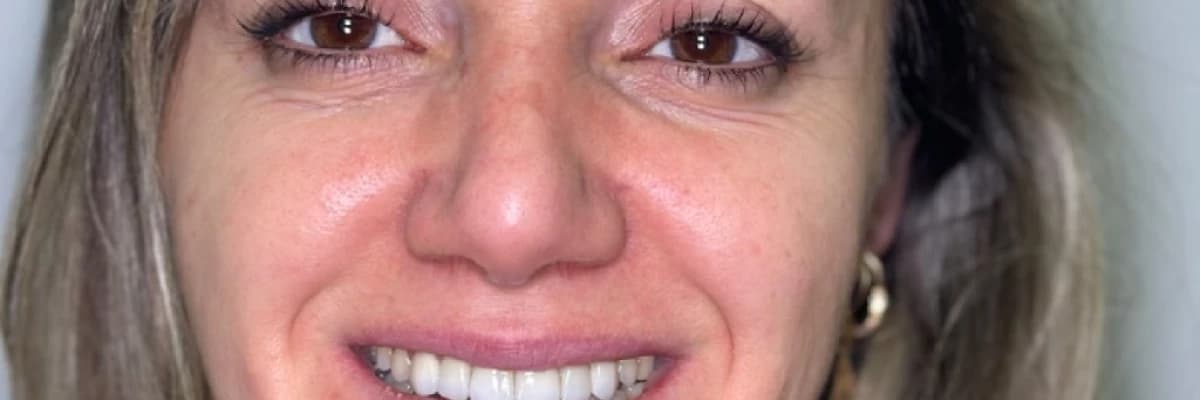 Yüz Estetiği ve Gülüş Tasarımı: Bir Bütünün Parçaları