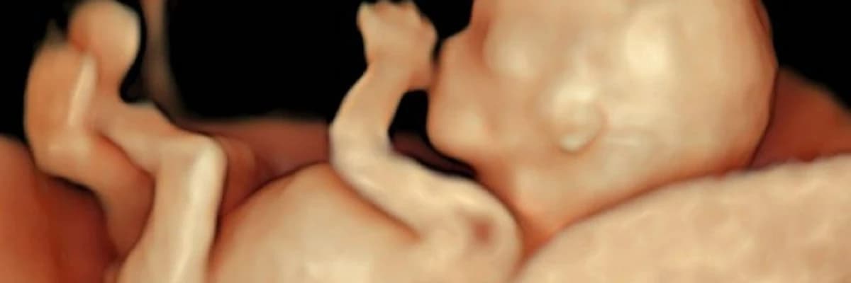 GEBELİKTE CİNSİYET NE ZAMAN BELLİ OLUR?