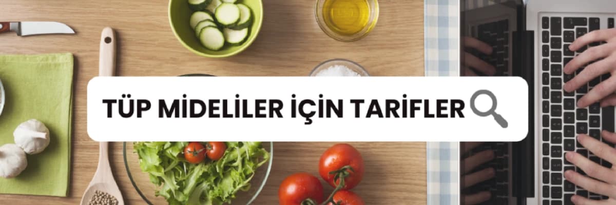 Tüp mideliler de yemekli misafir ağırlayabilir ve ağırlanabilirler