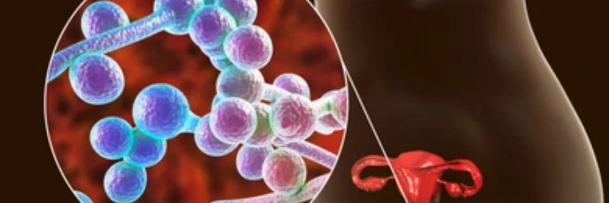 Vajinal Akıntı Nedir? Vajinada Kahverengi Akıntı Neden Oluşur?