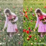 Katarakt nedir? Nasıl tedavi edilir?