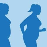 Obezite ameliyatı ile ilgili yanlış bilinenler