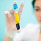 PRP (Platelet Rich Plasma)