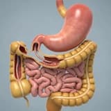 Transit Bipartisyon nedir?