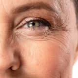 Nörotoksin (Botulinum Toksin) Uygulamaları