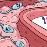 SPERM TESTİ NEDİR? | NE ZAMAN YAPTIRMALI? | YÖNTEM VE BİLMENİZ GEREKENLER