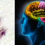 Emdr terapisi ve vaka örneği
