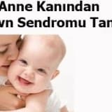 Anne kanından down sendromu