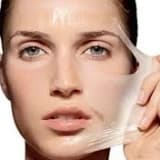 Peeling tedavileri