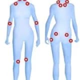 Fibromyalji agrı sendromu