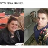 Obezitede cerrahi yöntem