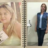 Obezitede cerrahi yöntem öncesi ve sonrası dönem