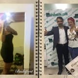 Mide balonu kimlere uygulanır ?