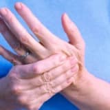 Raynaud fenomeni hangi hastalık ve durumlara eşlik edebilir?