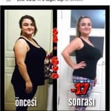 Obezite ve gebelik