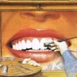 Gülüşte tasarım mümkün mü (smile designe)