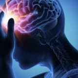 Epilepsi (sara hastalığı)