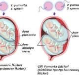 Çoğul ve İkiz Gebelik