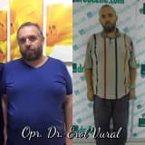 Obezite Cerrahisi Ve Karbonhidratların Seçimi