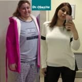 Obezite Ameliyatları Ve Sigara Alışkanlığı