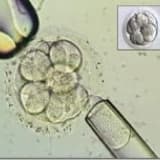 İnfertilite Ve Tüp Bebek