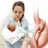Obezite Cerrahisinden Sonra Gebelik ve Doğum Kontrolü