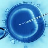 Tüp Bebekte Döllenme (IVF, ICSI)