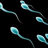Azoospermide Cerrahi Yöntemlerle Sperm Elde Etme