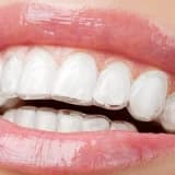 Ortodonti Nedir? Yetişkinlerde ve Çocuklarda Ortodonti