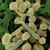 Kandida mantarı (candida albicans) sindirim rahatsızlıkları, dikkat eksikliği, fazla kilo ve depresyon nedenidir.