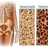 Osteoporoz Hakkında