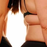 Metabolik Sendrom Nedir? Nasıl Önlenir?