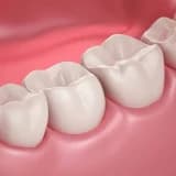 Dental bölgede ilerliyen yaşla oluşan değişiklikler