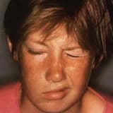 Tikler Hakkında Merak Ettikleriniz.