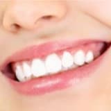 Diş beyazlatma nasıl yapılır? Diş beyazlatma zararlı mıdır?