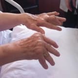 ROMATOİD ARTRİT (İltihaplı Romatizma)