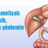 OBEZİTE (AŞIRI ŞİŞMANLIK )VE TÜP MİDE (SLEEVE GASTREKTOMİ )OPERASYONU