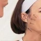 MİNİ YÜZ GERME OPERASYONU ( SHORT SCAR MINI FACE LİFT )