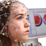 Elektroensefalografi (eeg) nasıl uygulanır?