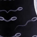 Azosperm nedir ? Nasıl Tedavi Edilir ?