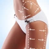 Liposuction ( Vakumla Yağ Alma ) Nedir? Neden Uygulanır?