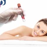 PRP Tedavisi - Platelet Rich Plasma