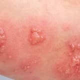 En büyük sebebi stres, sizi uykudayken yakalıyor! İşte zonanın bilinmeyen yüzü