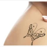ND:YAG (Q-SWITCHED) LAZER İLE DÖVME SİLİNMESİ