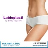 Labioplasti için uygun adaylar kimlerdir?