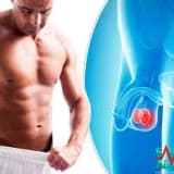 Genç yaşta en sık rastlanan ürolojik kanser: Testis Kanseri