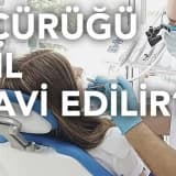 Diş çürüğü nasıl tedavi edilir?