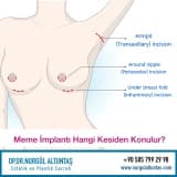 Meme Büyütmede Kesiler