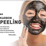 Karbon peeling uygulaması ve avantajları