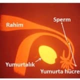 Halk arasında İnfertilite: Kısırlık